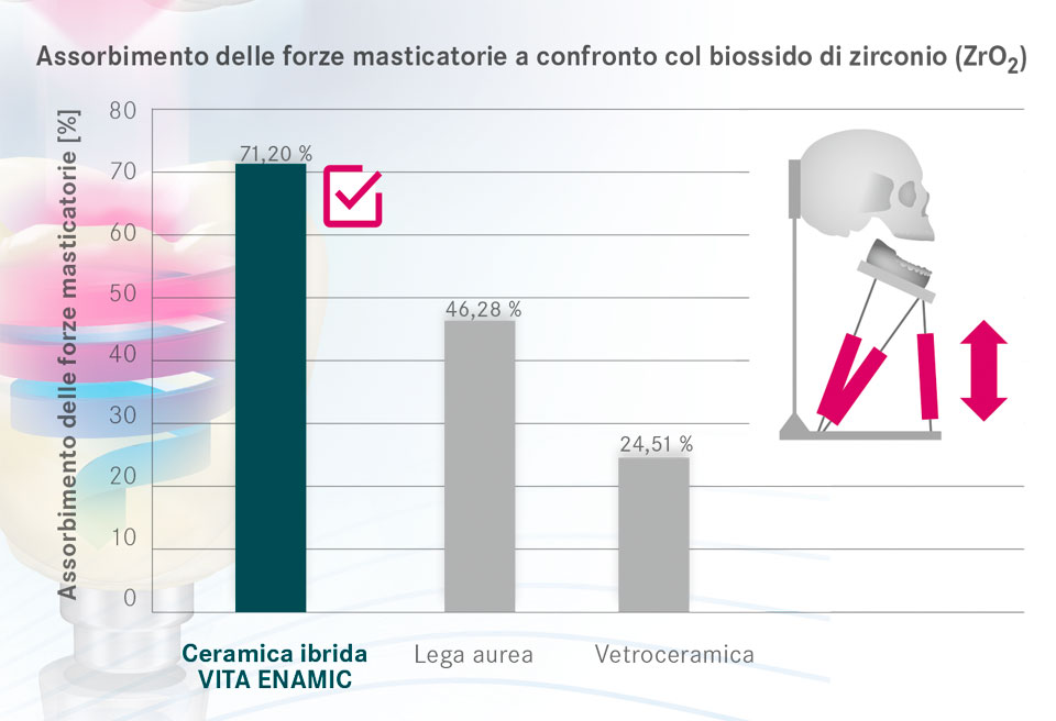 Fonte: Università di Genova, Reparto di Protesi dentaria fissa e implantare, Dr. Maria Menini et al., Genova, Italia; 01/2015
