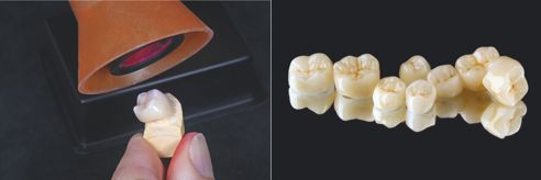 Fig. 6: Antes del sellado de las superficies con VITA ENAMIC GLAZE se fija mediante polimerización el maquillaje aplicado.
Fig. 7: Las coronas de los dientes posteriores terminadas (en la imagen: maxilar inferior).