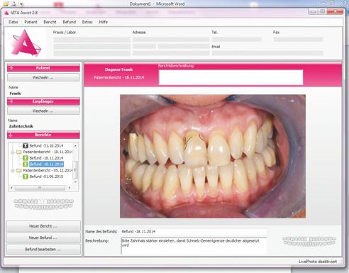 Visualisierung der am Zahnhals zu breiten Krone 11 und Korrekturvorschlag im Beschreibungsfeld – so kann dem Labor einfach vermittelt werden, was zu ändern ist.