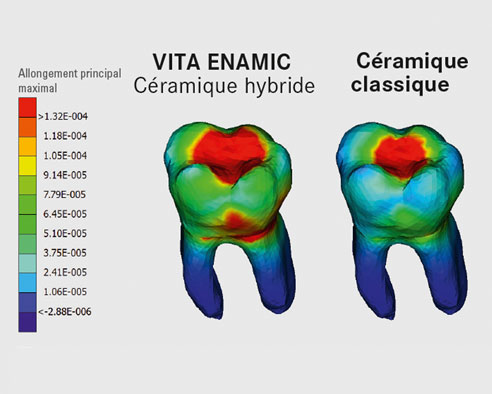 Ill. 3 : Modèle virtuel d'une dent en VITA ENAMIC et en céramique.