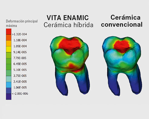 Fig. 3: Modelo dental virtual de VITA ENAMIC y cerámica.