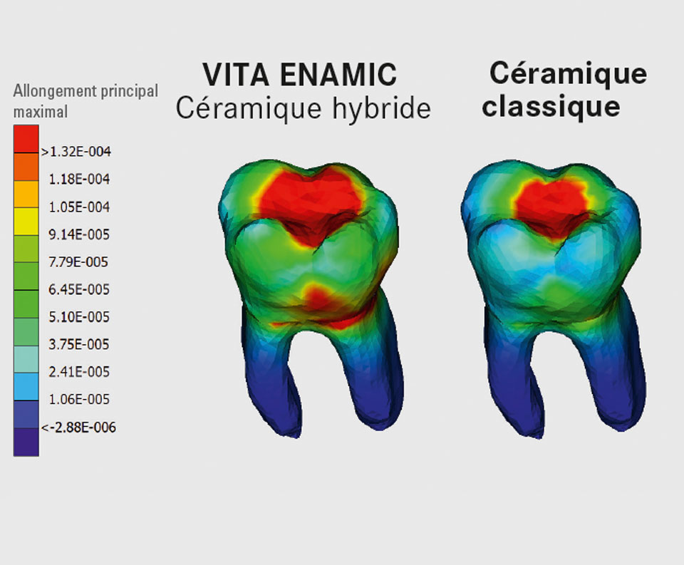 Ill. 3 : Modèle virtuel d'une dent en VITA ENAMIC et en céramique.
