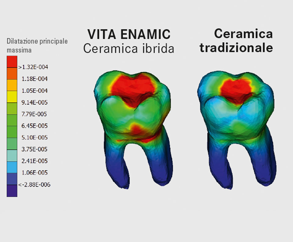 Fig. 3: Modello virtuale di dente in VITA ENAMIC e ceramica.