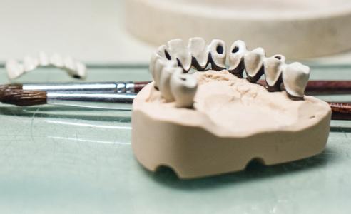 Fig. 8: La estructura opaquizada conforme al color dental base escogido.