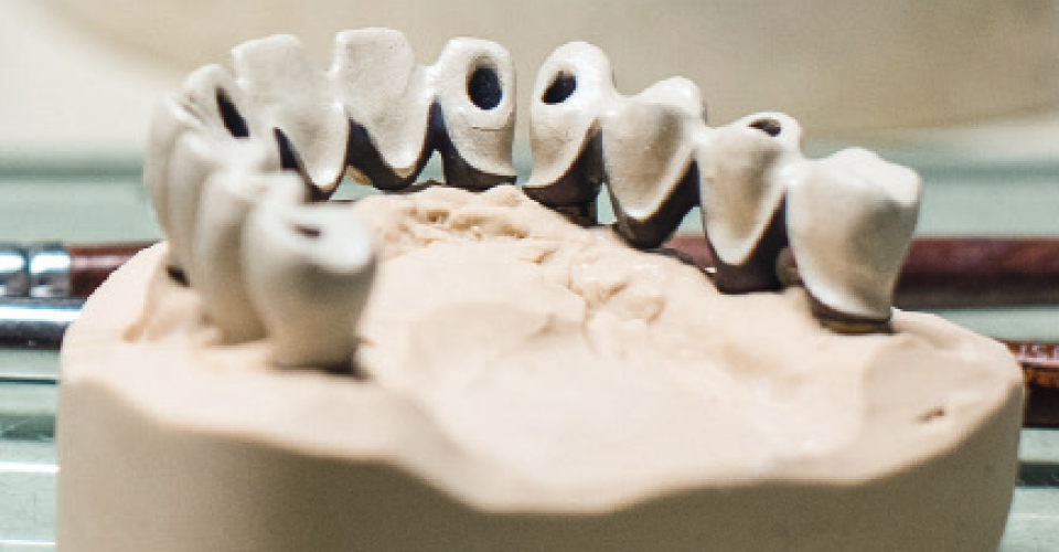 Fig. 8: La estructura opaquizada conforme al color dental base escogido.