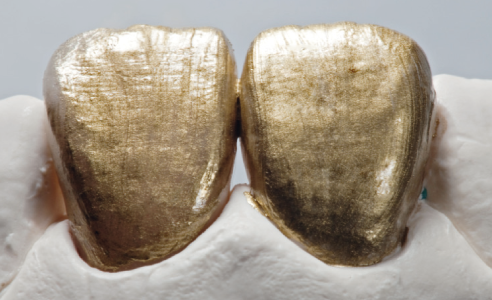 Fig. 14: Un marker d'oro per tessitura serve a evidenziare otticamente la struttura superficiale.