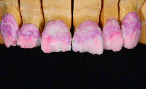 Fig. 4: BASE DENTINE 2M1, cervical EL4 (yellow) and INT05 (terracotta), as well as EC8 (beige) in the middle area.