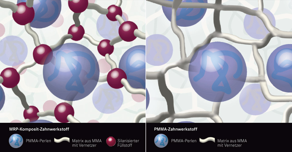 Abb. 3a/b: Gegenüberstellung von MRP-Komposit (links) und PMMA (rechts) mittels schematischer Darstellungen der Materialstruktur.