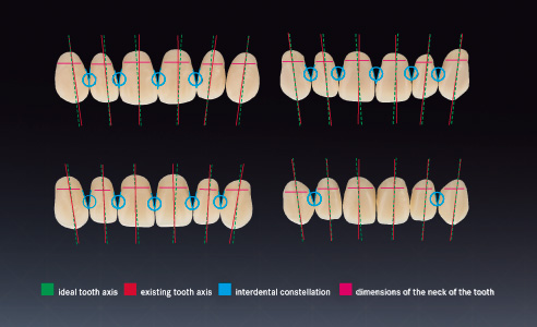Fig. 4: Tooth features of different selected dental products used as examples. Analysis by expert panel of dental technicians.