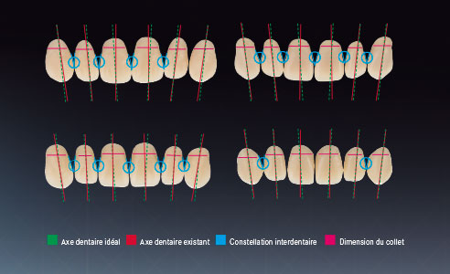 Ill. 4 : Caractéristiques des dents de différentes gammes dentaires sélectionnés à titre d'exemple. Analyse par un panel d'experts prothésistes dentaires.