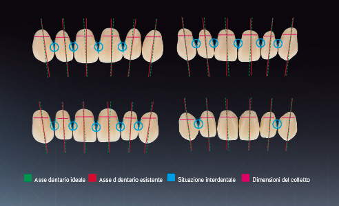 Fig. 4: Caratteristiche di differenti linee di denti selezionate come esempi . Analisi a cura di un gruppo di odontotecnici esperti.