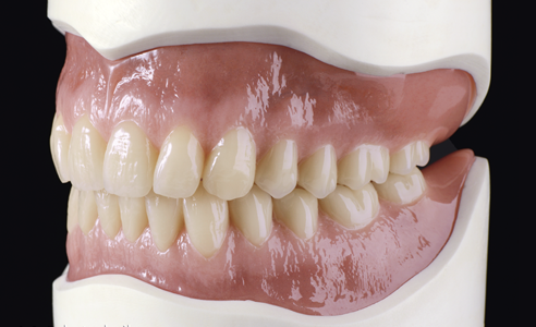 Abb. 9: Korrekte vertikale Krümmungsmerkmale erlauben einen natürlichen Übergang vom Processus Alveolaris/Jugea alveolaris über das marginale Parodont zum eigentlichen Zahn.