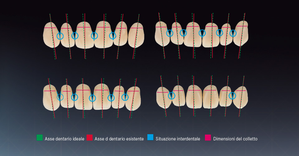 Fig. 4: Caratteristiche di differenti linee di denti selezionate come esempi . Analisi a cura di un gruppo di odontotecnici esperti.