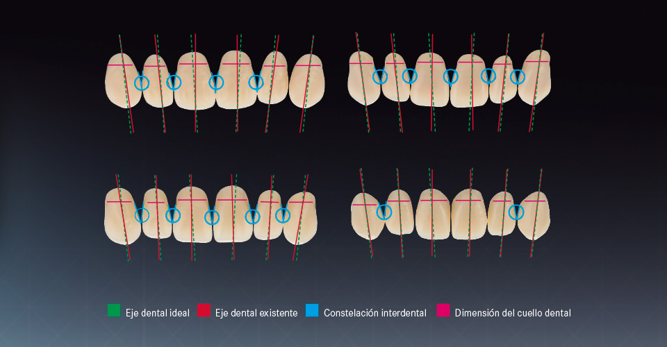 Fig. 4: Características de distintos dientes prefabricados seleccionados a modo de ejemplo. Análisis por un panel de protésicos dentales expertos.