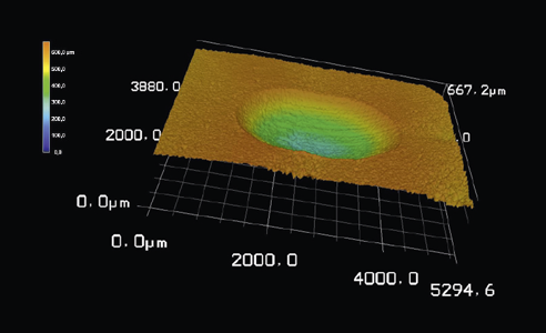Fig. 4: After analysis of the samples using 3D laser microscopy, significantly lower maximum wear was determined for VITA PHYSIODENS made of MRP composite in comparison.